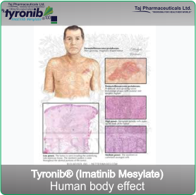 Chronic myeloid leukaemia
